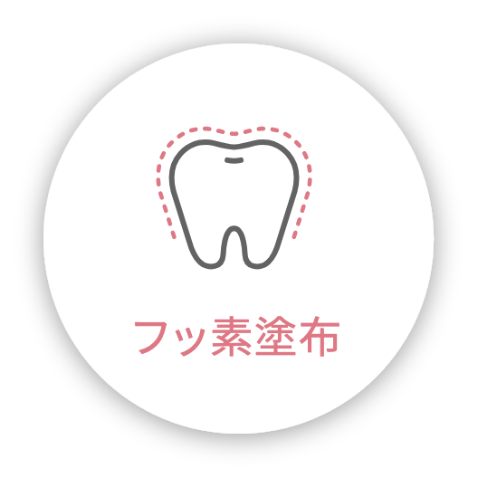 フッ素塗布