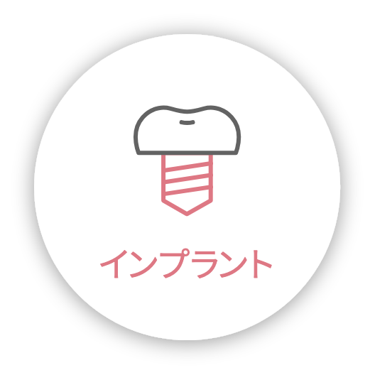 インプラント