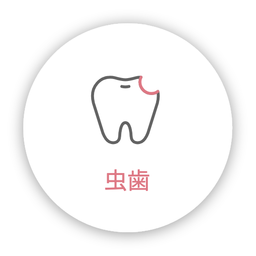 虫歯