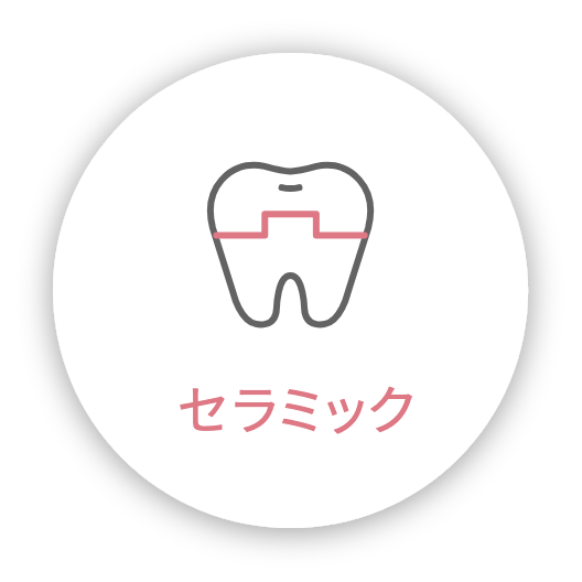 セラミック