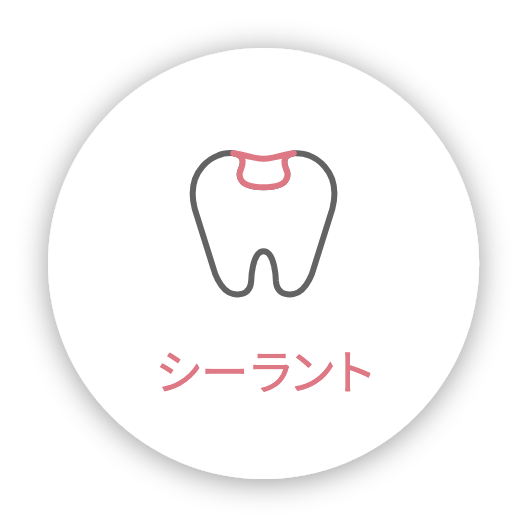 シーラント